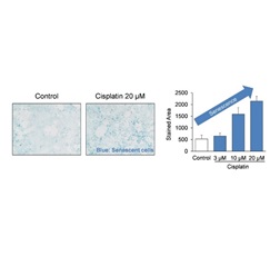 Figure 1. Increase in SA-β-gal stain-positive cells with cisplatin