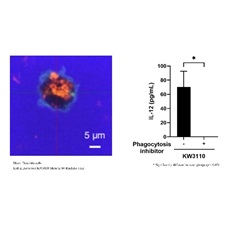 Attachmen Figure 2. Effects of uptake by human dendritic cells and inhibition of uptake on the induction of IL-12 production