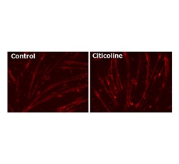 【Figure 2】Neuromuscular cell model with AChR stained in red