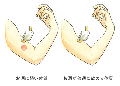 お酒に弱い体質 お酒が普通に飲める体質